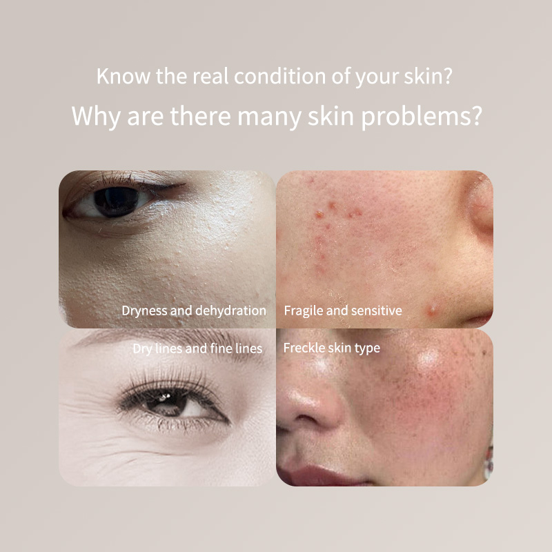 Skincare Only You - Draagbare huidtesterpen - alleen voor gezicht