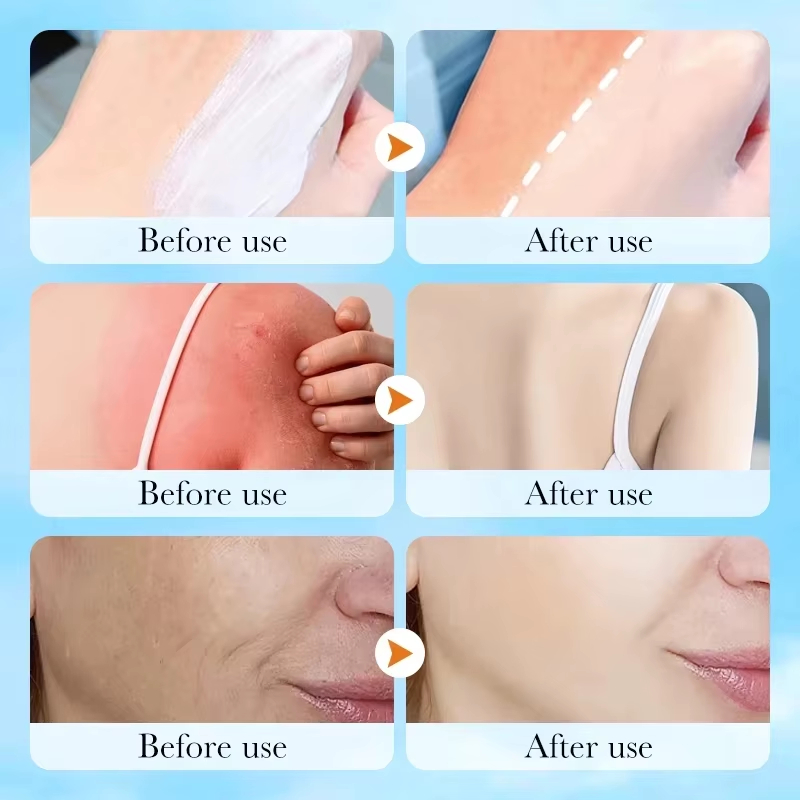 Koreaanse SKIN1004 Centella Ai - Skincare Skin 1004 recensie en prijs