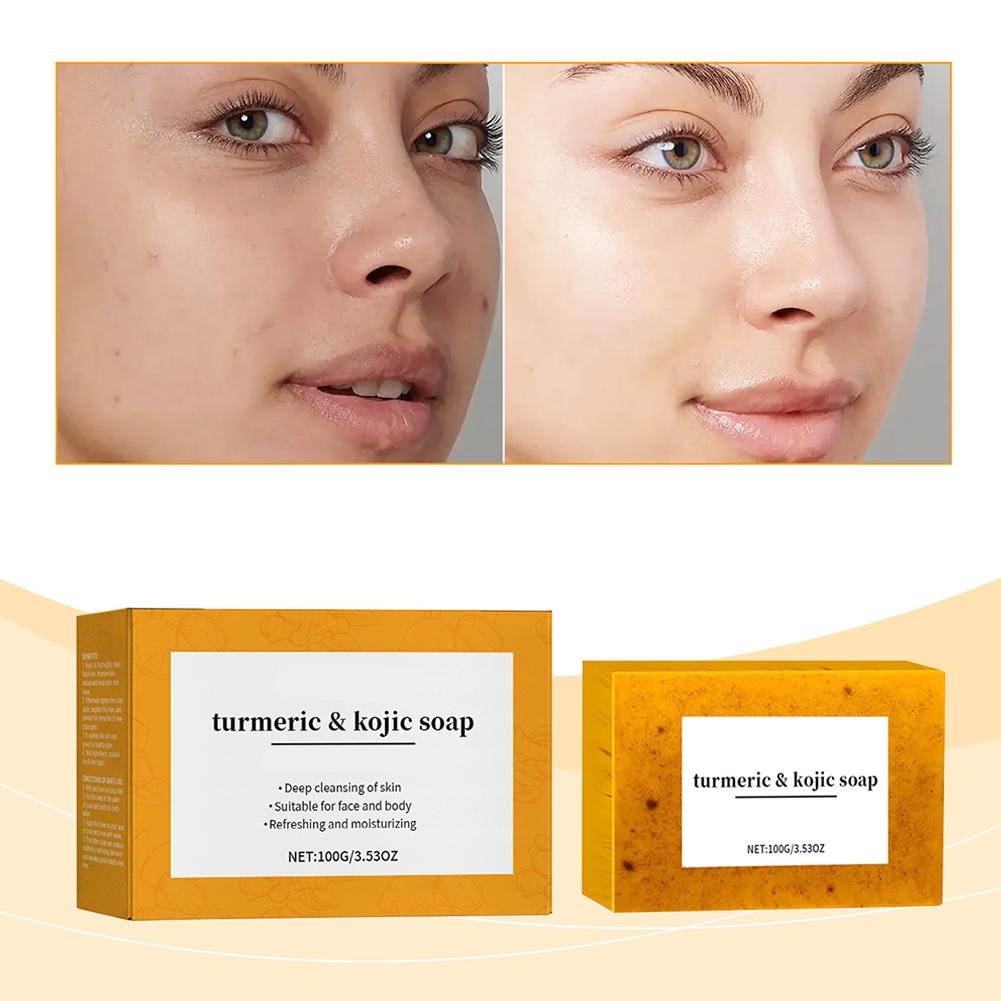 100g Kurkuma Handgemaakte Zeep - Kojic Acid Soap recensie en prijs