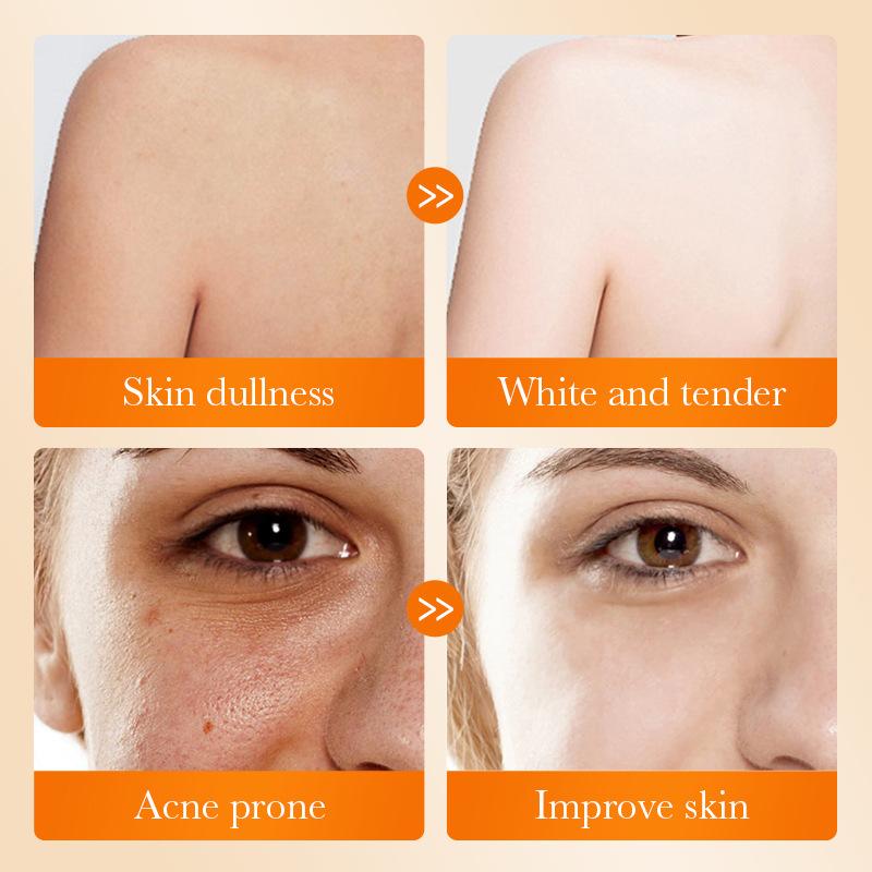 1Pc SADOER Kojiczuur Gezichtsz - Kojic Acid Soap recensie en prijs