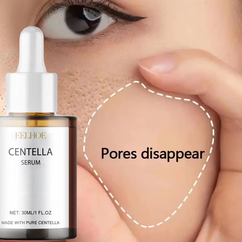 Centella Asiatica Serum voor h - Centella Asiatica Toner recensie en prijs